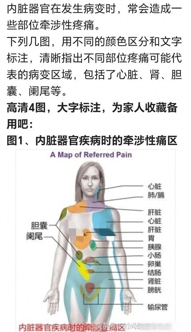 人体脏器疼痛信号内脏图片