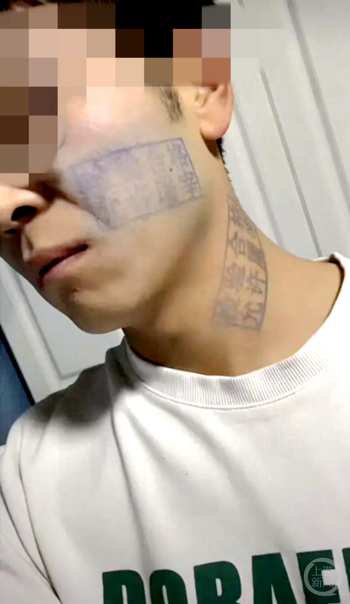 陈先生脸上的猪肉章要慢慢消除。 