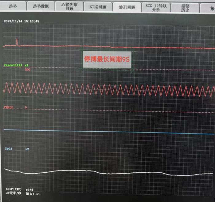 七旬娭毑心衰停搏達9秒一波三折醫生奮力救治