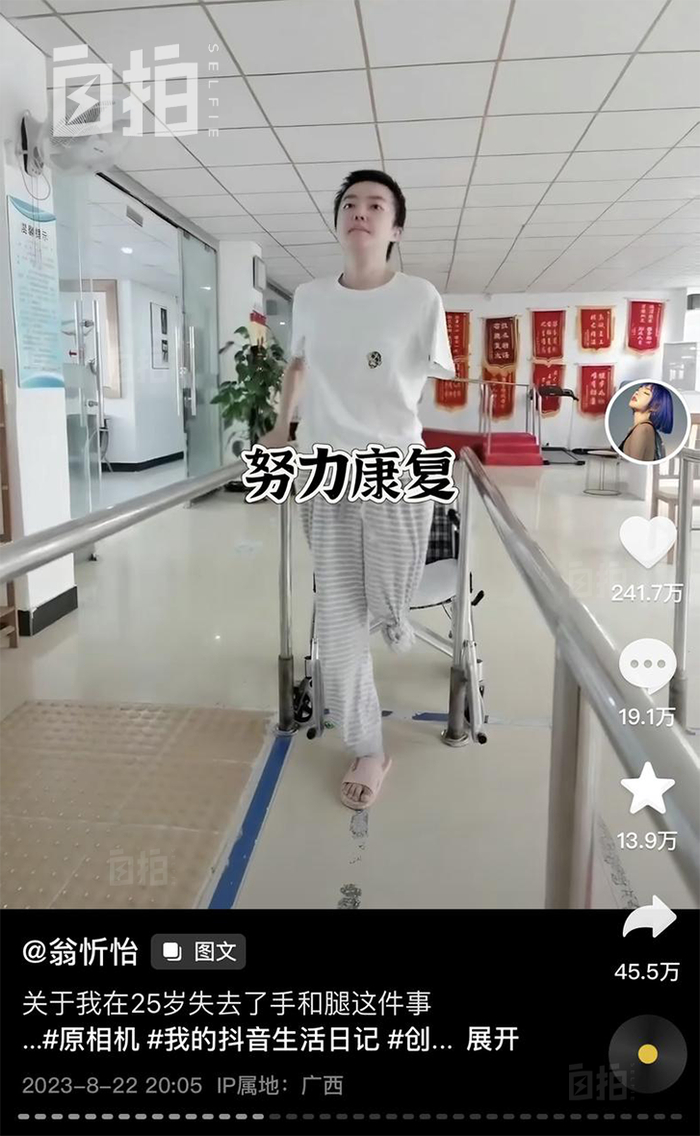 我,25岁失去左手左腿,重生后穿短裙出街,假肢是我的时尚单品