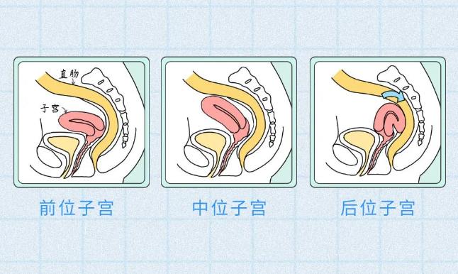 大多数女性的子宫是前位的子宫是女性独有的器官仰着睡——影响子宫