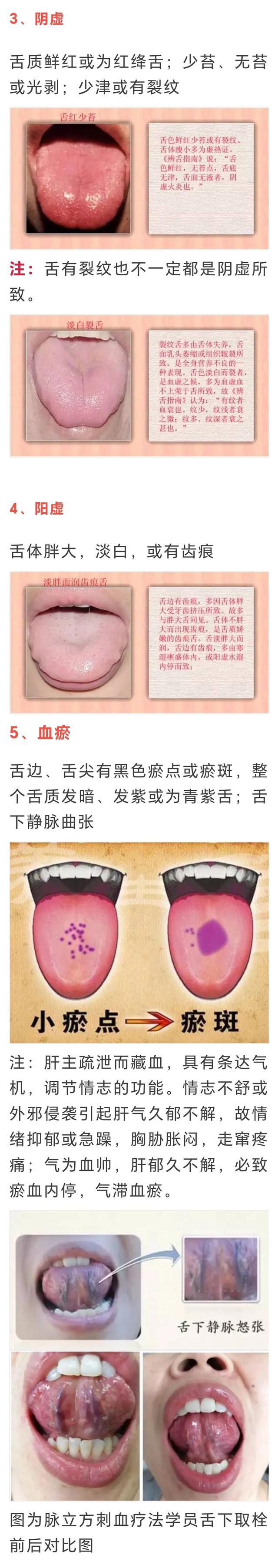 中医总看舌头,都在看什么?九种体质+舌诊图谱|中医|体质_新浪新闻