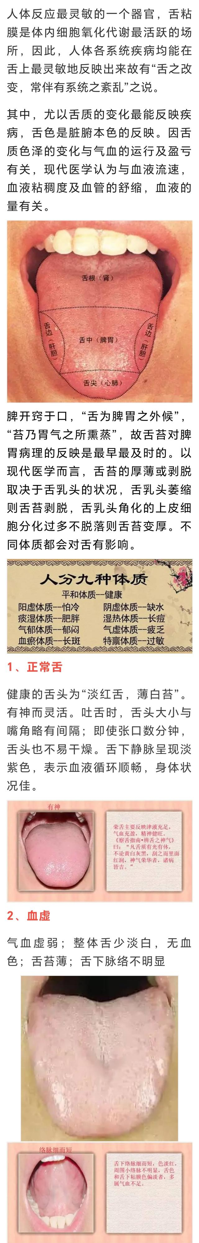 中医总看舌头，都在看什么？九种体质+舌诊图谱|中医|体质_新浪新闻