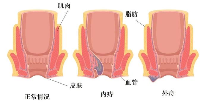 被