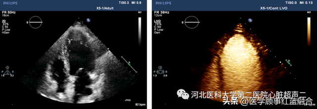 家长学校心声怎么写 学生成长心声及表达方法