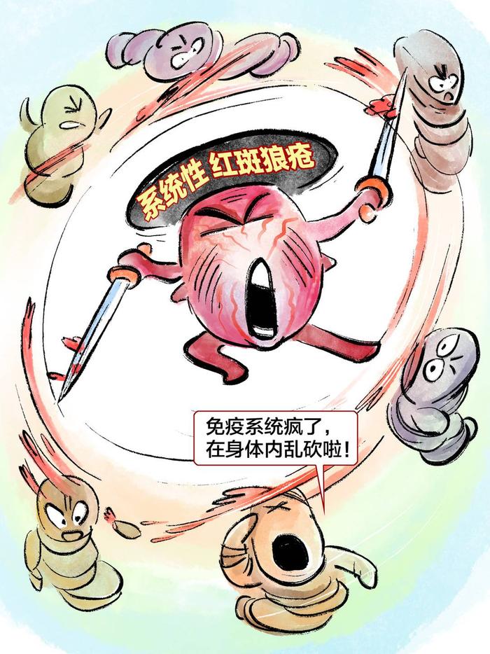 系统性红斑狼疮漫画图片