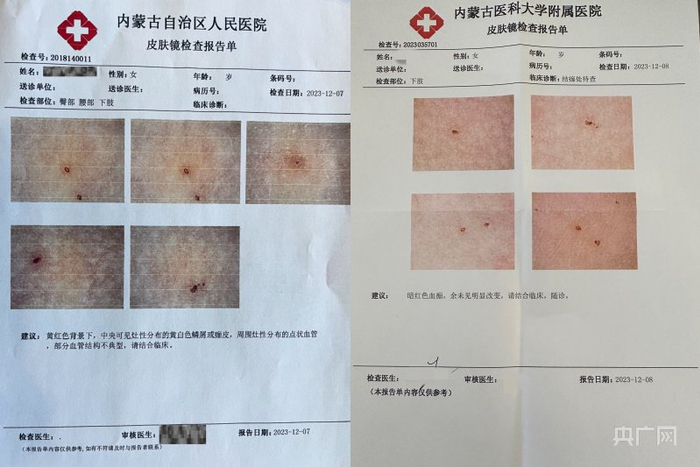 医院出具的检查报告单(央广网见习记者 刘晓祺 摄)
