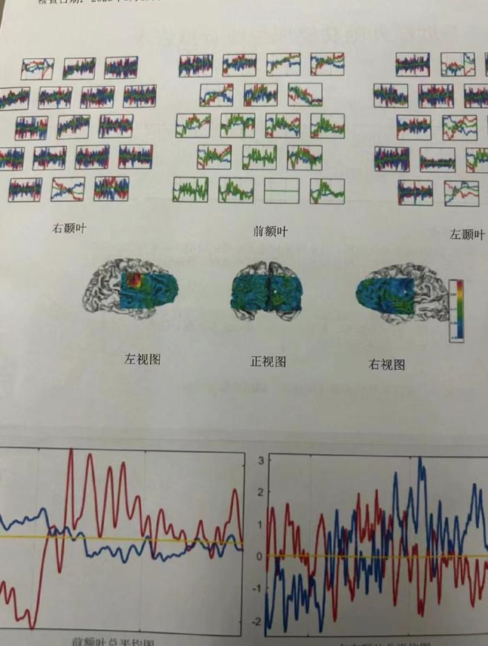 確診adhd,成了聰明人的「時髦病」|聰明人_新浪新聞