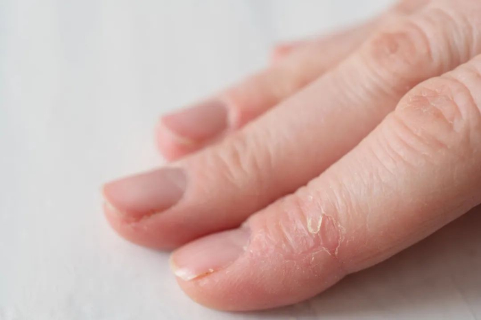 图库版权图片，转载使用可能引发版权纠纷