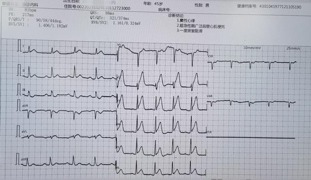 (患者出現頻發性室性早搏呈ront現象)15:49分,患者到達湖南旺旺醫院