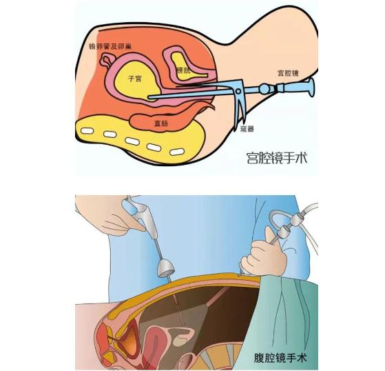 西安生殖保健院婦科微創中心近年來不斷追求技術研究及創新,開展各類