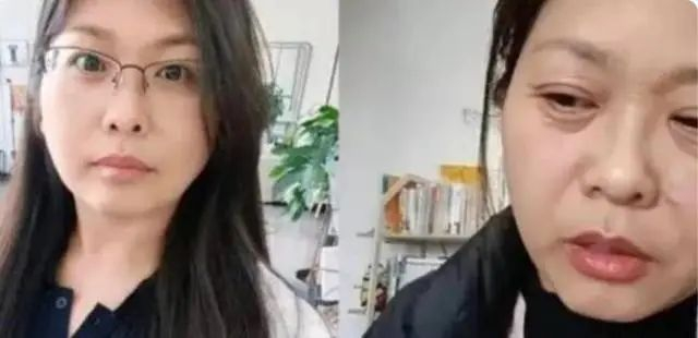 近日山东一位42岁女子发视频称，自己被诊断为卵巢早衰后“断崖式衰老”，“看起来像70多岁”。图源/网络