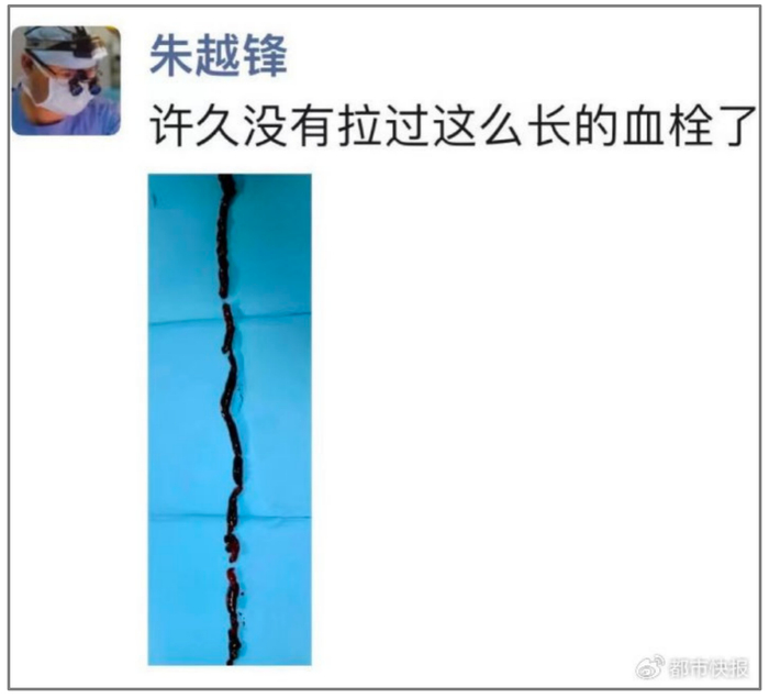 医生朋友圈截图。都市快报图