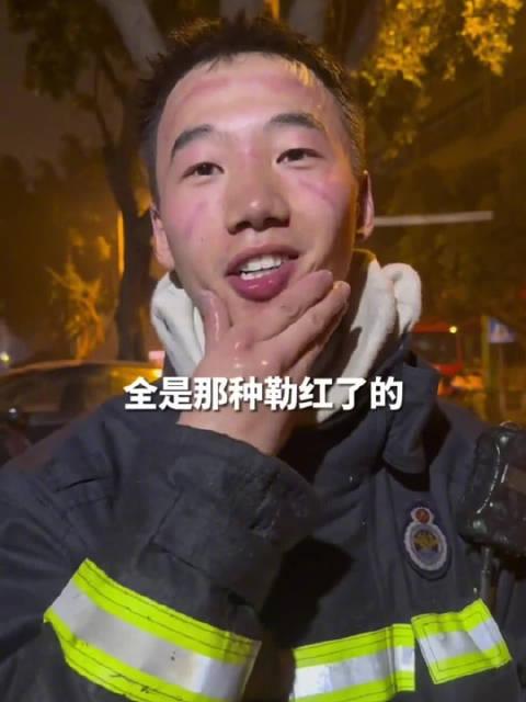 消防員滅完火後臉被勒出深深紅印