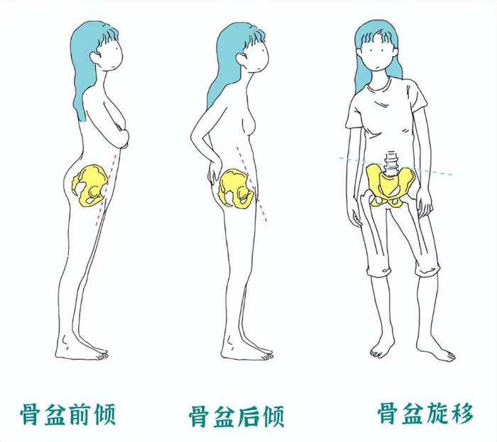 前倾,后倾,旋移等都有几率发生影响整个人的体态更会影响情绪副乳在