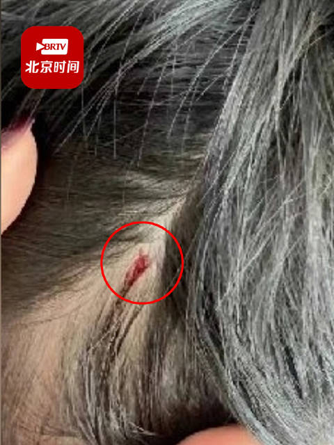 学校通报小学老师将学生头部打出血停课道歉记过处分调离教学岗位