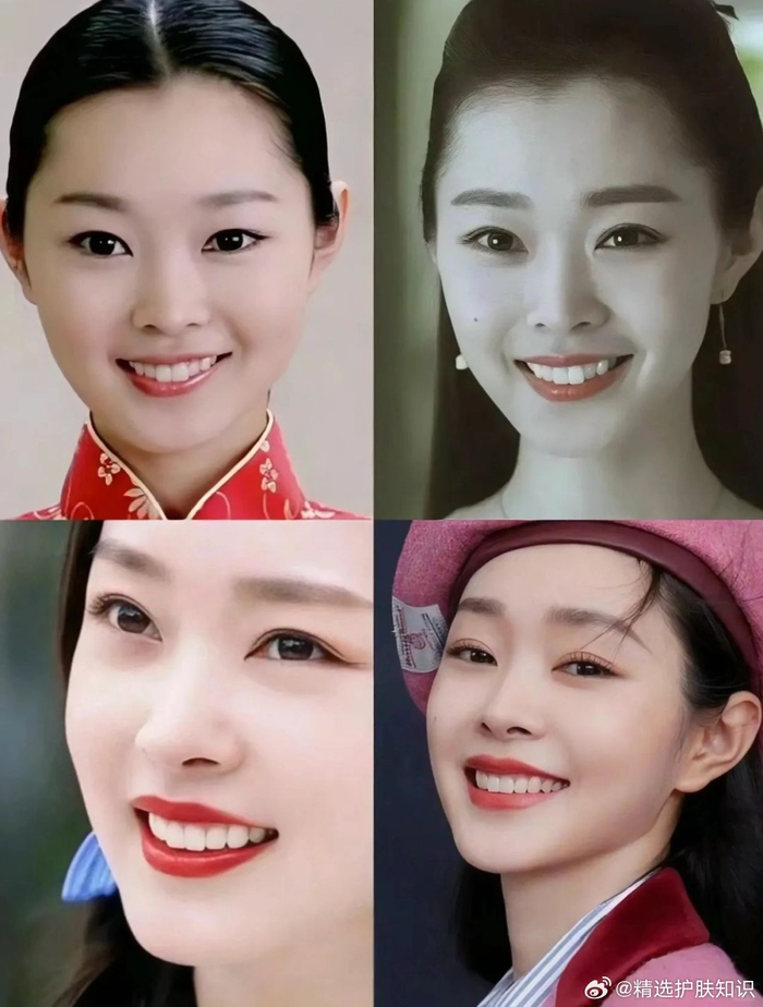 娱乐圈的哑巴新娘都整牙了 在娱乐圈里……|娱乐圈|哑巴新娘|宋轶