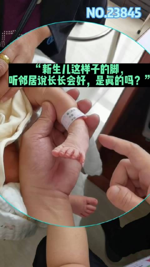 新生儿这样子的脚听邻居说长长会好是真的吗