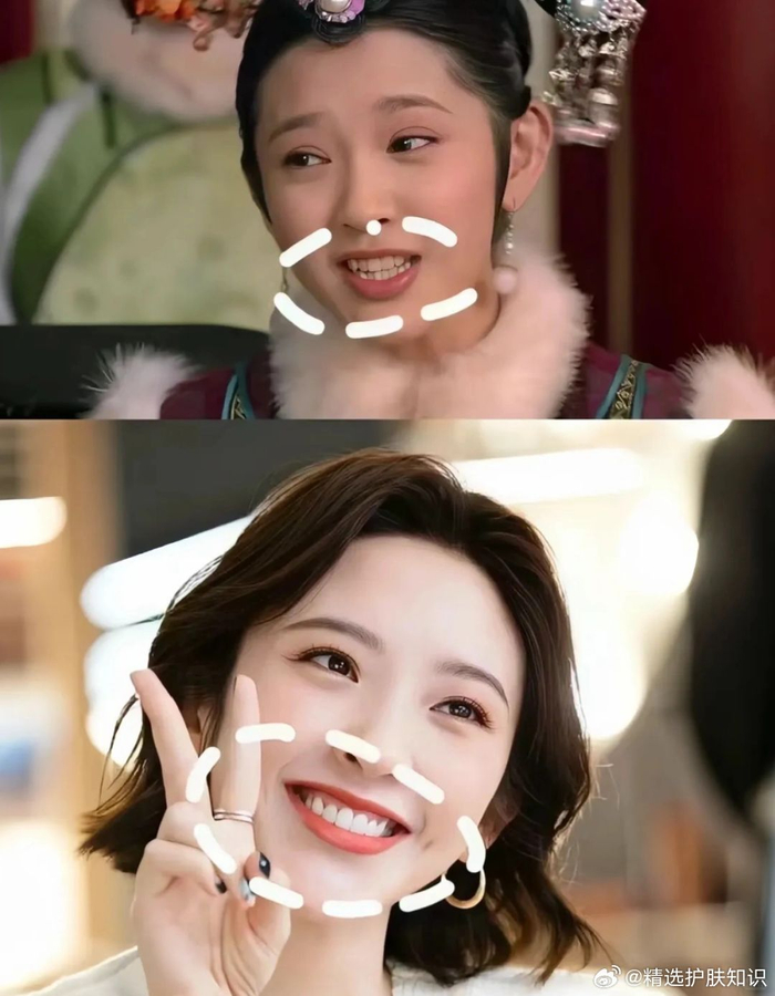 娱乐圈的哑巴新娘都整牙了 在娱乐圈里……|娱乐圈|哑巴新娘|宋轶