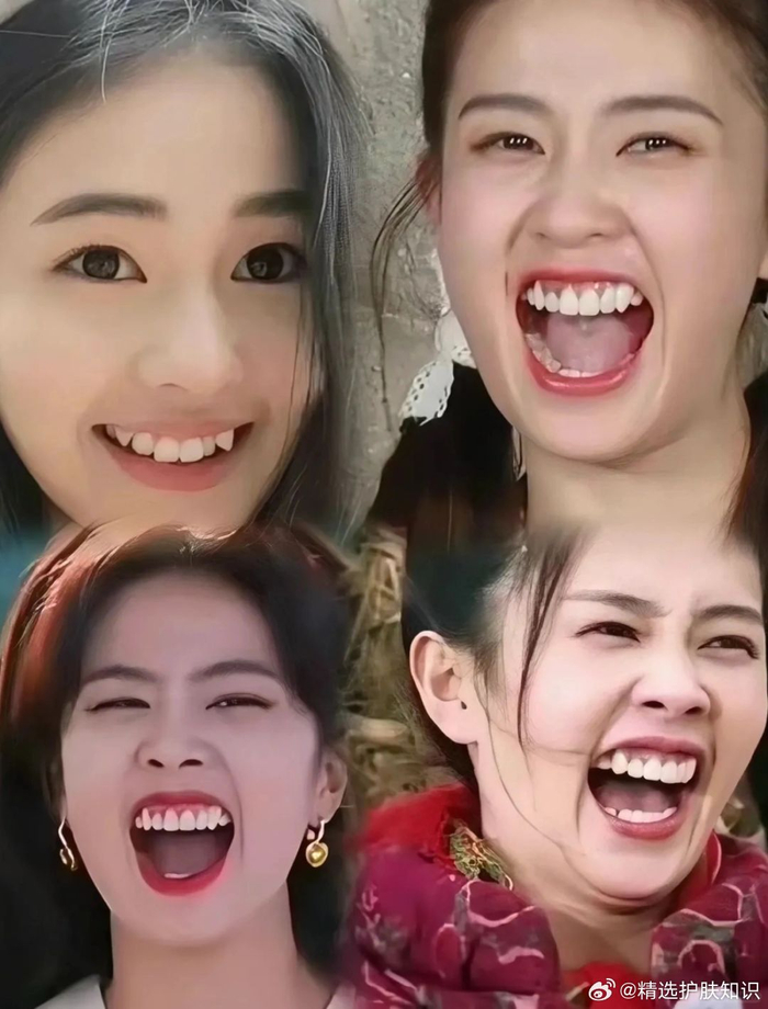 娱乐圈的哑巴新娘都整牙了 在娱乐圈里……|娱乐圈|哑巴新娘|宋轶