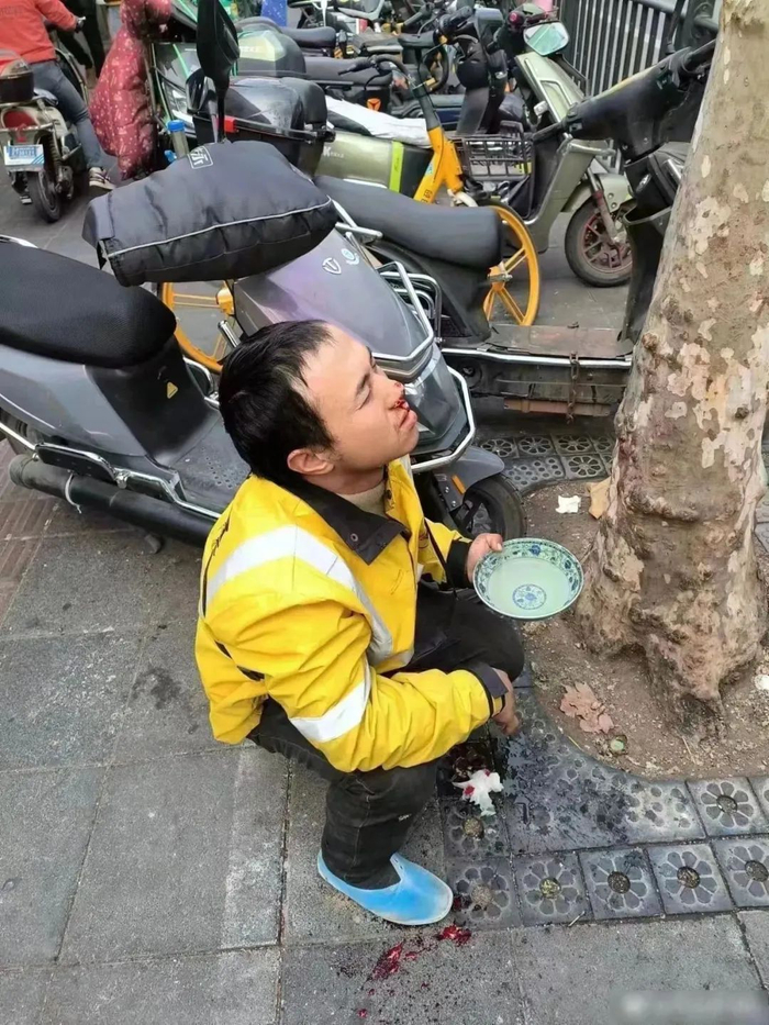 网传图片发生在去年12月，实为陈思上火流鼻血图片 。