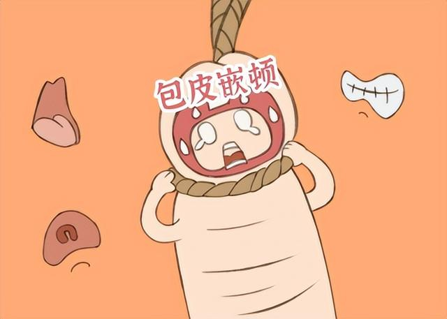 家有小男子汉包皮过长,到底要不要"割"?家长们看完就懂!