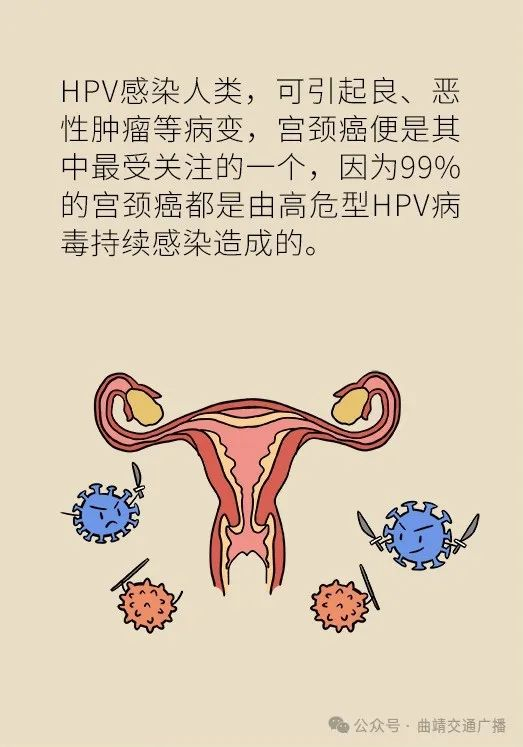 呵护女性健康 重视早癌筛查|宫颈癌|感染|子宫内膜癌_新浪新闻
