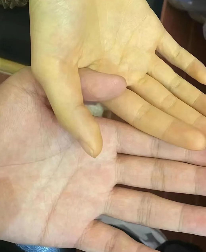 (不只是变黄)|胡萝卜素_新浪新闻