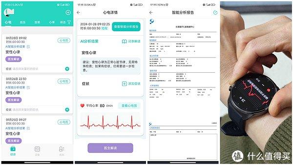 app中的报告有详细的解释说明,并有分析报告和心电片段图,可以咨询