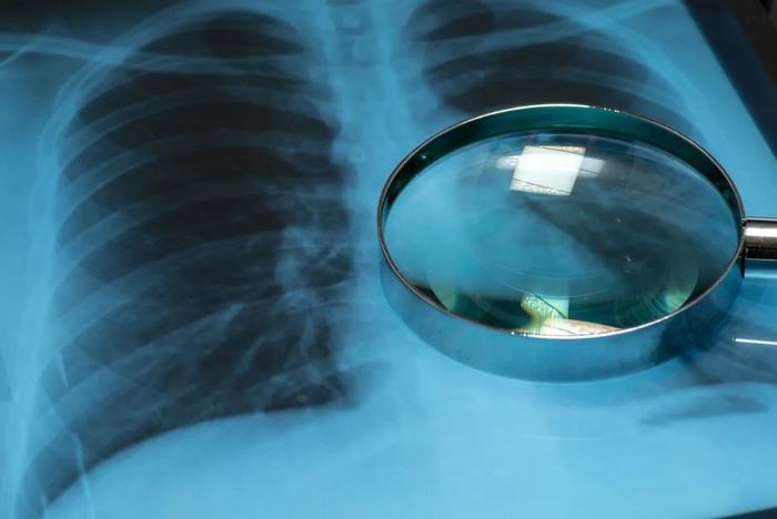 图库版权图片，转载使用可能引发版权纠纷