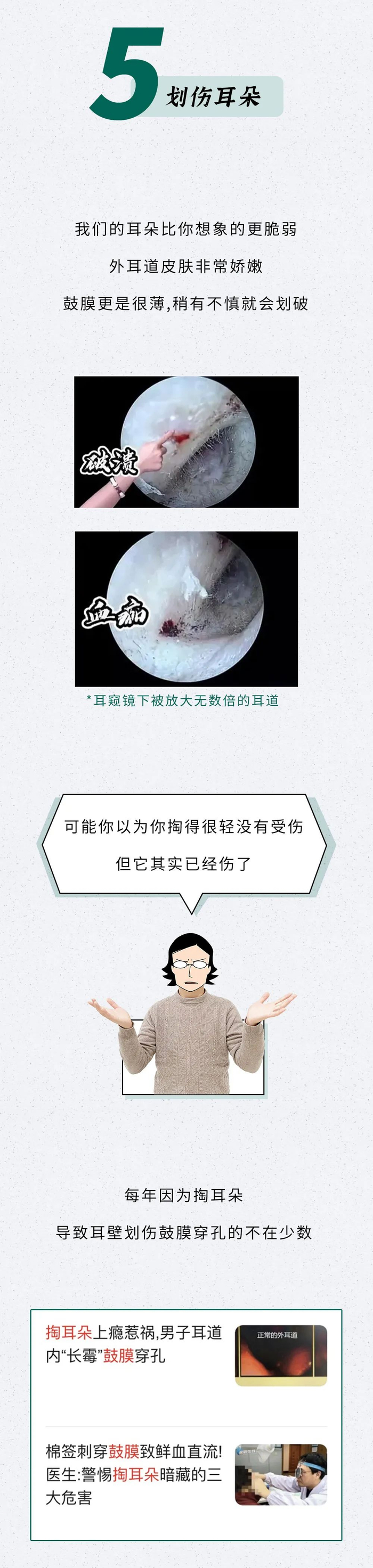 看看你的耳朵都烂成啥样了!