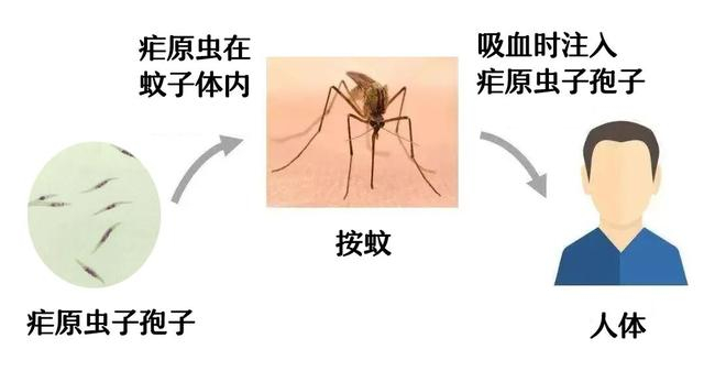 疟疾|感染|广东_新浪新闻