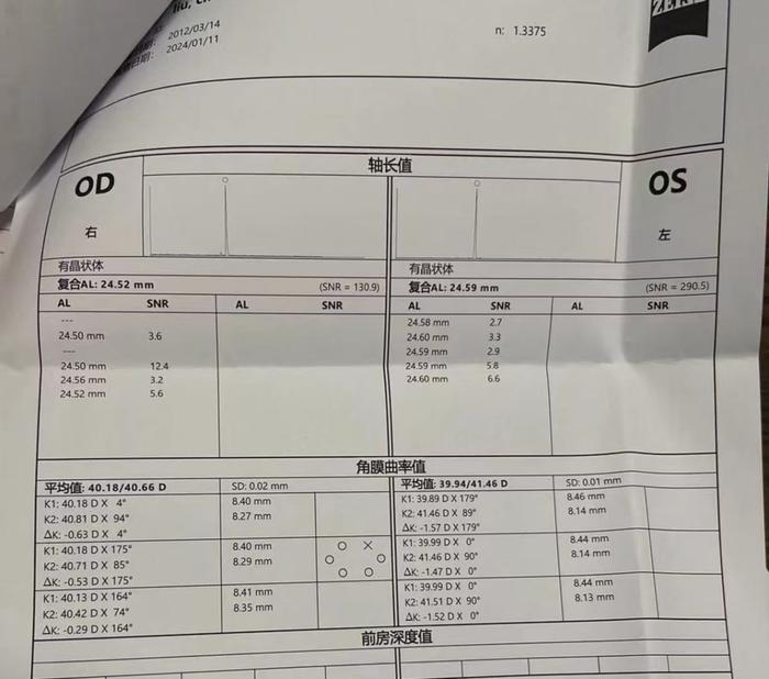 案例分析|低曲率,長眼軸兒童的近視控制|近視_新浪新聞