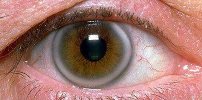 图源：arthur hayes