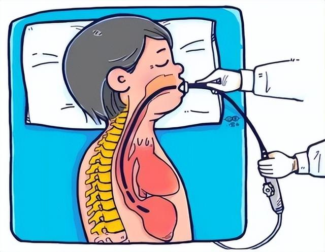 3分钟带你了解经食道超声心动图检查|食管|超声|心动_新浪新闻