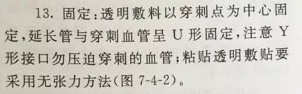 为什么要用留直针留置针一定要 U 型固定?怎么固定才最合适?_新闻资讯_第1张_活检穿刺产品网 为什么要用留直针留置针一定要 U 型固定?怎么固定才最合适?_https://www.jmylbn.com_新闻资讯_第1张