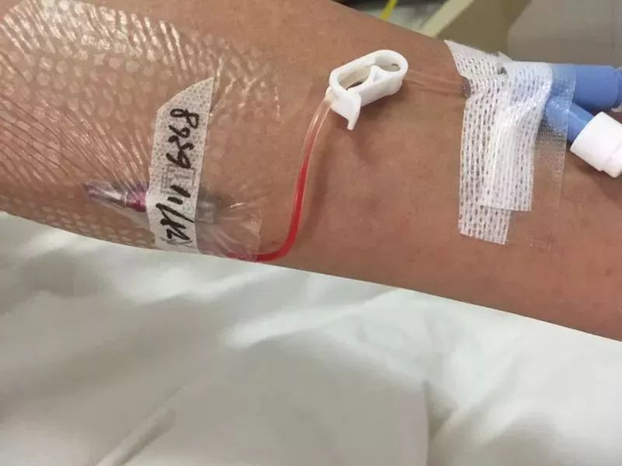 知道吗留置针活塞的夹闭位置会影响留置效果