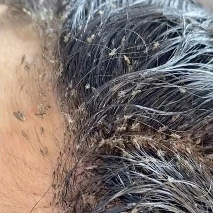 人类不长毛,是为了吸引异性么?