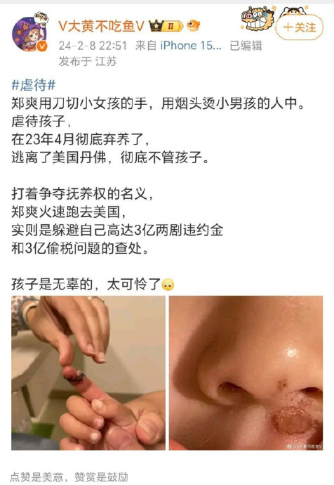 总结:郑爽虐孩子,切小女孩的手,用烟头烫小男孩的人中……|郑爽|张恒