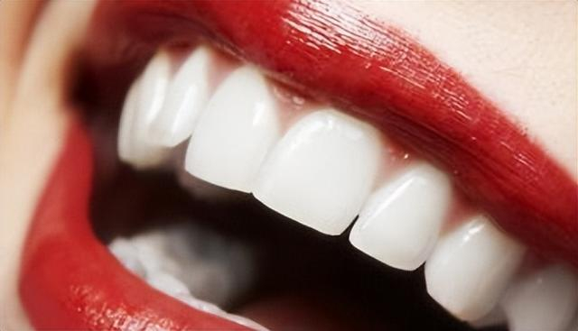 要做吗|牙齿_新浪新闻