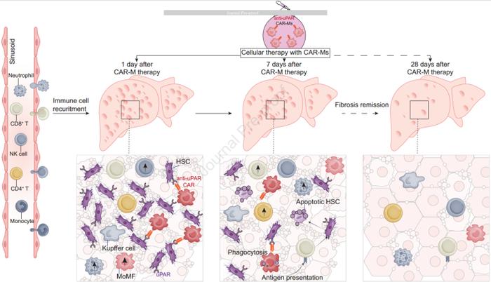 的巨噬细胞改善临床前模型中的肝纤维化