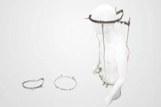 头颅-骨盆环示意图。图源/网络