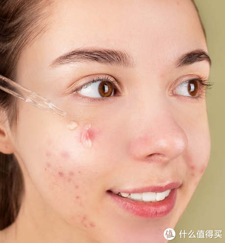 不可能有人看不懂版烂脸急救喂饭级换季皮肤异常快速修护指南