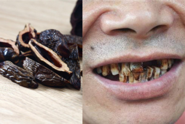 不想得口腔癌的必看!|口腔癌|槟榔_新浪新闻