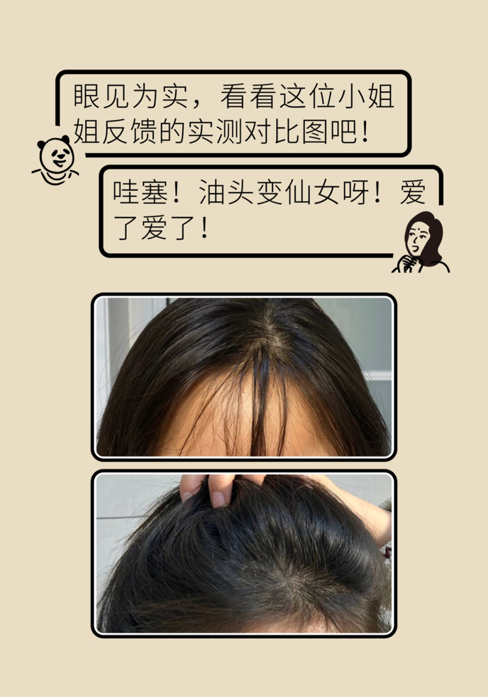 头发一天就油还发痒做对这简单一步悄悄就解决
