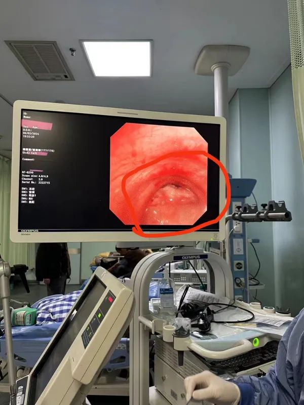 吃汤圆被卡喉我市已发生多起元宵吃汤圆要注意