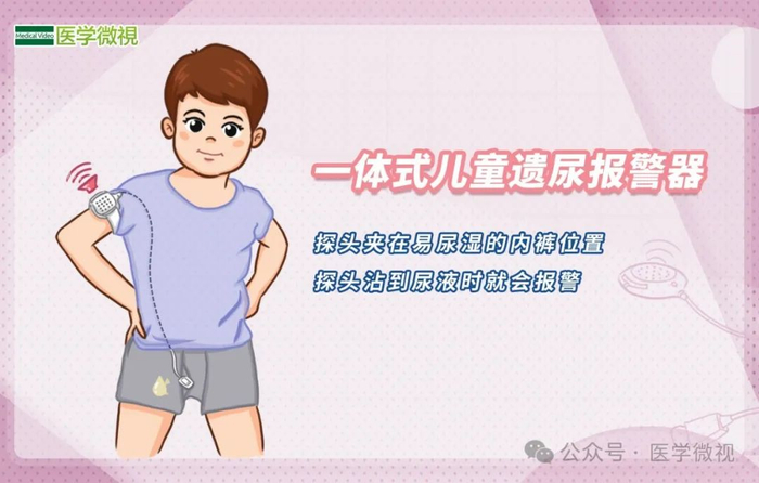 小儿遗尿又称非器质性遗尿或功能性遗尿,通常系指儿童>5岁后>仍不自主