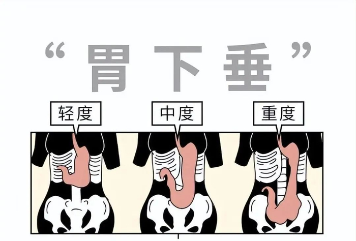 肚子|腹横肌|小肠_新浪新闻