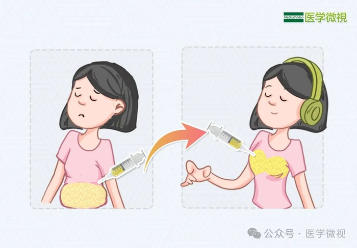木瓜丰胸靠谱吗丰胸瘦肚子一举两得有绝招