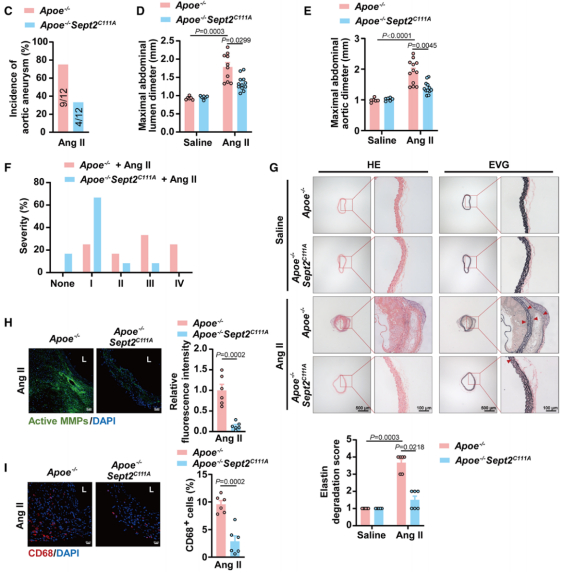 circulation | 南京医科大学季勇/谢利平/王东进发现加重主动脉瘤和
